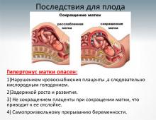 Σφιχτό στομάχι κατά τη διάρκεια της εγκυμοσύνης Όταν το στομάχι γίνεται σκληρό κατά τη διάρκεια της εγκυμοσύνης