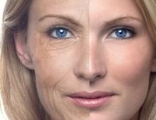Aging of facial skin in women - causes, age-related changes What ages a woman after 40 years